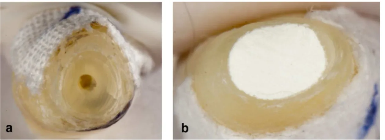 Fig. 4 View after apical resection a. After preparation of the root canal with round bur b