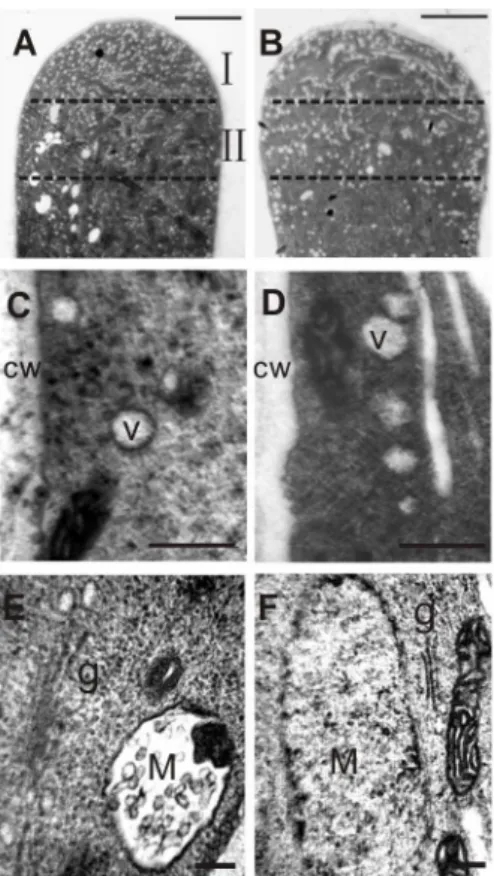 Figure 4. Ultrastructural observation of abnormal post-Golgi trafficking in RNAi pollen tubes