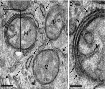 Figure 5. Mitochondria (M) attached to endoplasmic reticulum (a). Part (b), a higher magnification of the inset of panel (a), shows the contact site (arrow heads) between mitochondria (M) and an endoplasmic reticulum profile