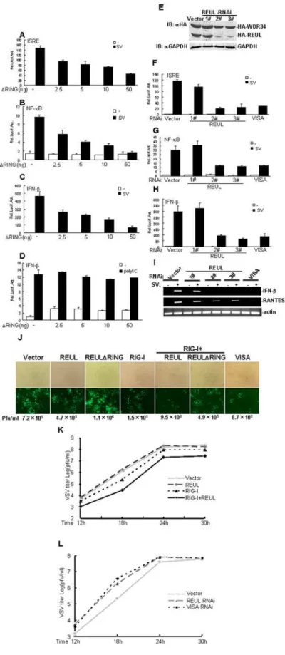 Figure 4. REUL potentiates RIG-I antiviral activity. (A), (B), (C) RING domain deletion mutant REULDRING suppresses SV-induced activation of ISRE (A), NF-kB (B) and IFN-b (C) promoter in a dose-dependent manner