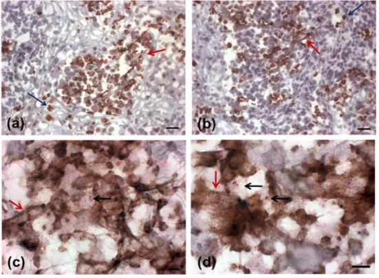 Fig 1. Detection of NETs in active lesions. (A, B) Presence of NETs in an active lesion detected by neutrophil elastase immunostain(red arrows) in sections counterstained with Mayer`s hematoxylin (bar = 25μm)