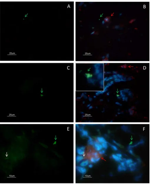 Fig 3. Colocalization analysis of CD68(+) macrophages and amastigotes by immunofluorescence.
