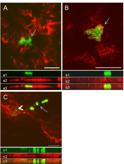 Fig 4. Colocalization analysis of NETs and amastigotes by confocal microscopy. (A) NETs containing neutrophil elastase (red) and amastigotes (green, arrow)