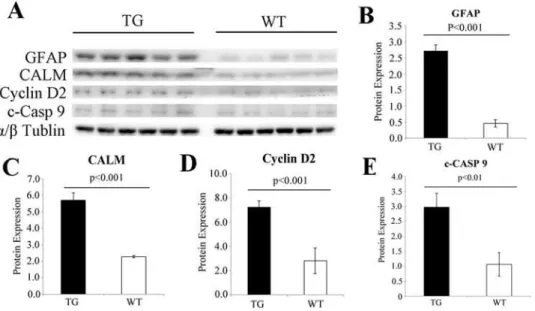 Fig 3. Western blot validation of target gene expression. (A-E) Western blot analysis revealed significant upregulation of proteins related to gliosis, calcium signalling pathway and p53 signalling pathways