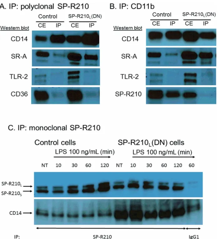 Fig 5. Interaction of SP-R210 with innate immune receptors. Immunoprecipitation experiments were carried out using 5 mg/mL (A and B) or 2.5 mg/mL (C) cell extracts from control and SP-R210 L (DN) macrophages with polyclonal anti-SP-R210 (A) or monoclonal C