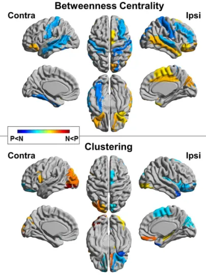 Fig 5. Regional comparisons of the TLE-N and -P groups for betweenness centrality and clustering.