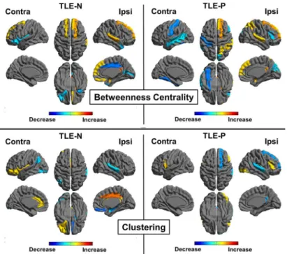 Fig 6. Regional comparisons of each TLE group with the healthy group for betweenness centrality and clustering