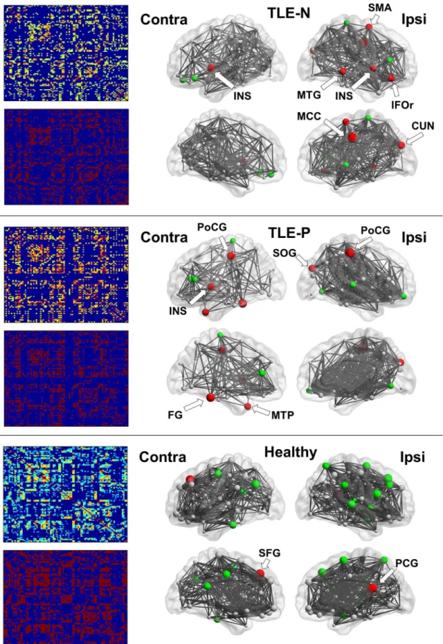 Fig 2. The results of association matrices (left) and network hub nodes and edges (right)