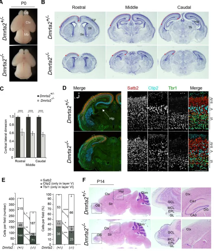 Figure 3. Reduced cortical size in Dmrta2 -deficient mice. (A) Newborn (P0) brains of Dmrta2 mutants