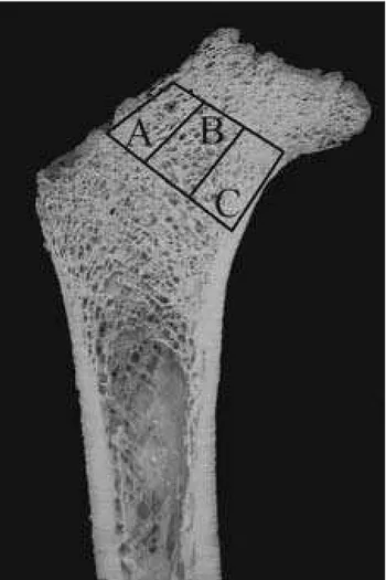 Figure 1. Femoral cross-section displaying three regions of interest: 