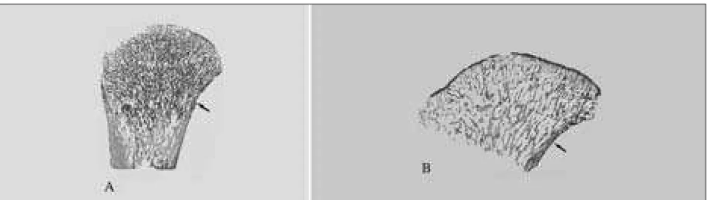 Figure 5. Low power microscopic view (100 µm undecalcified section, unstained) of proximal femora aged 3 months (A) and 5 months (B) showing  primarily longitudinal bone trabeculae