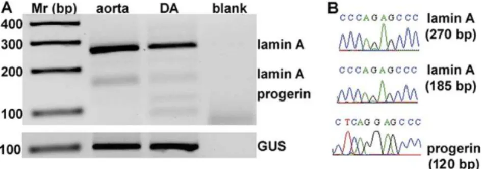 Figure 2. RT-PCR reveals expression of progerin mRNA in DA. A. RT-PCR analysis of LMNA and progerin mRNA in neonatal aorta and DA was performed with primers that amplify 270 and 185 bp of LMNA , and 120 bp of progerin