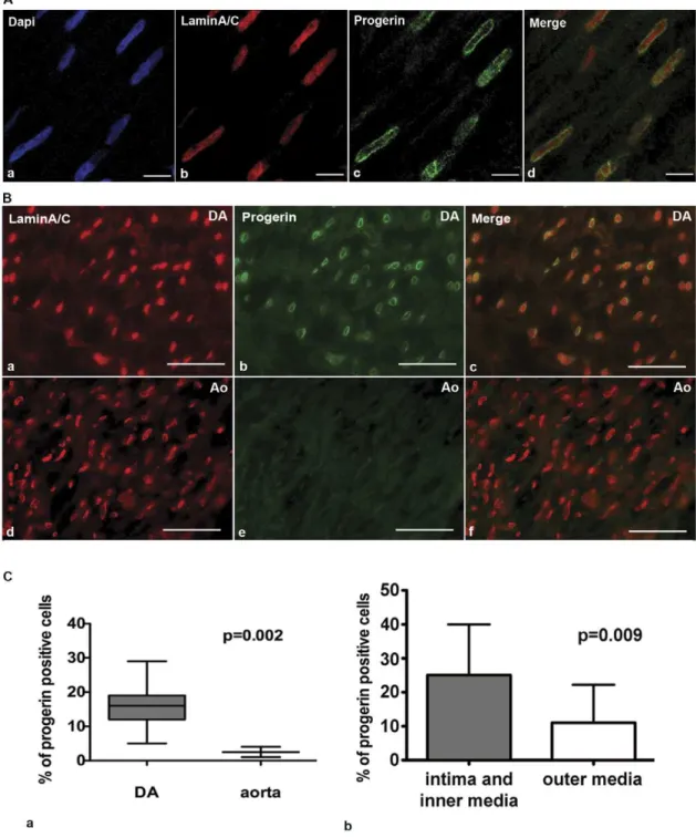 Figure 3. Spatial changes of progerin expression in a neonatal DA. A. (b) Confocal images of immunofluorescence show even nuclear distribution of lamin A/C (red) and (c) nuclear envelope localization of progerin (green) in the media of DA