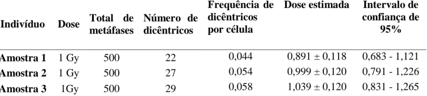 Tabela 1: Dose estimada e intervalo de confiança de 95% nas três amostras estudadas  analisando a frequência de dicêntricos por células