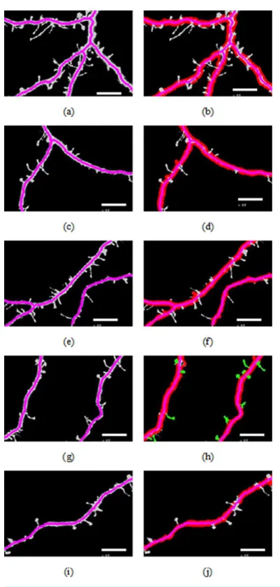 Figure 3 Results of backbone extraction and boundary location.