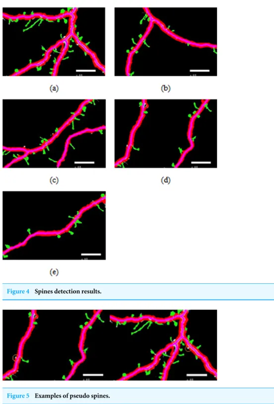 Figure 4 Spines detection results.