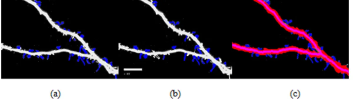 Figure 7 Spine detection result of ROI_ 1 via (A) Manual (B) Su’s method (C) RTSVM.
