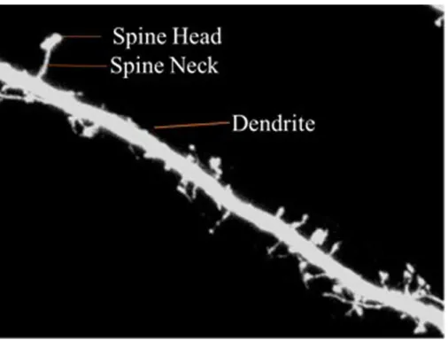 Figure 1 Dendritic spine.