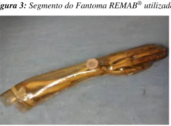 Figura 3: Segmento do Fantoma REMAB ®  utilizado. 
