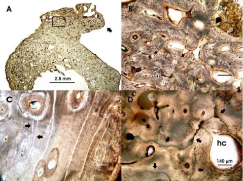 Figure 3. Histopathological bone features. Representative bone ground sections observed under transmitted light microscope: A