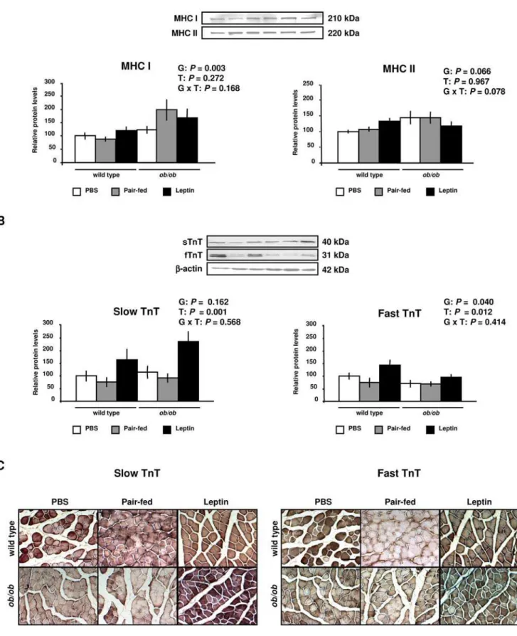 Figure 6. Leptin Increases the Expression of Contractile Proteins in Skeletal Muscle. (A) Representative Western blot analyses of myosin heavy chain type I (MHC I), myosin heavy chain type II (MHC II), slow and fast troponin T (TnT) proteins of gastrocnemi