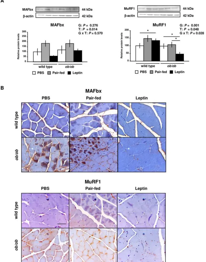 Figure 3. Leptin Decreases MAFbx and MuRF1 Protein Expression in Gastrocnemius Muscle of Wild Type and ob/ob Mice