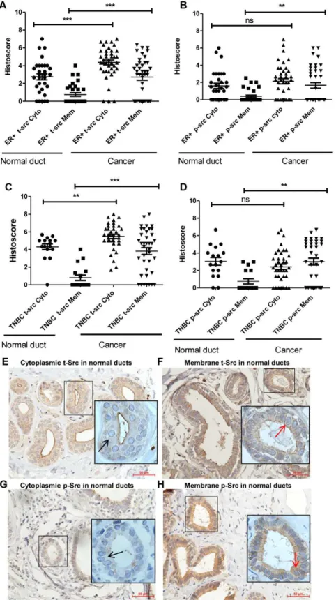 Figure 1. Src expression in breast cancer tissue and adjacent normal ducts of ER+BC and TNBC