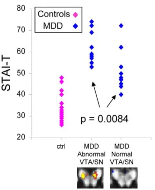 Figure 6. FA difference in the normal VTA/SN MDD subgroup in secondary a priori areas of evaluation