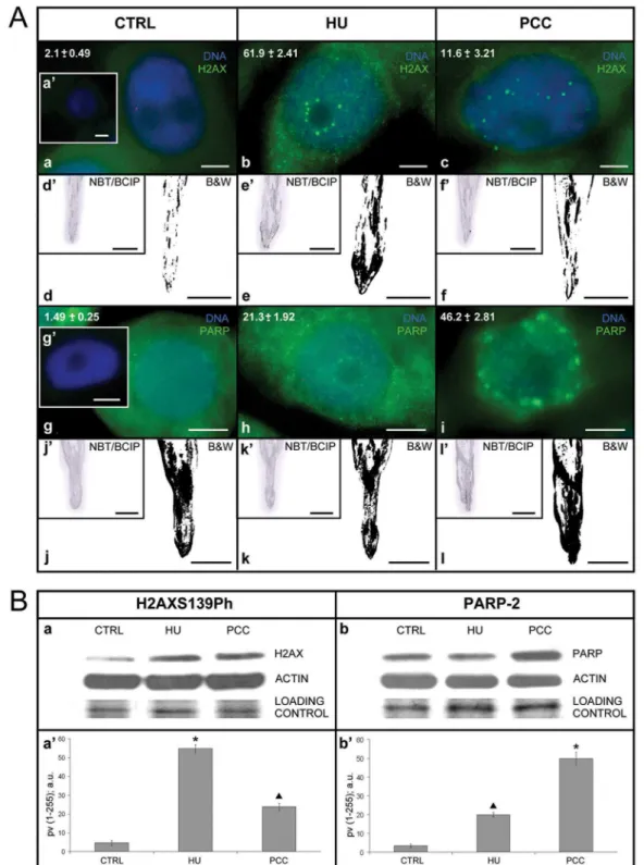 Fig 1. Histone H2AX phosphorylated at S139 (H2AXS139Ph) is a marker of double-stranded breaks (DSBs), while poly(ADP-ribose) polymerase-2 (PARP-2) is a marker of single-stranded breaks (SSBs)