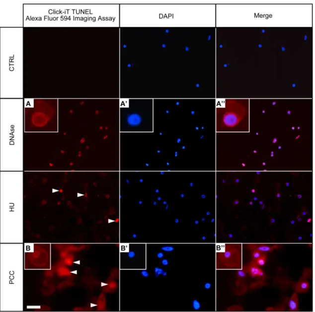 Fig 3. Terminal deoxynucleotidyl-dUTP nick end labeling (TUNEL) assay in Click-iT technology in the untreated control (negative), DNase-treated control (positive), HU-treated and HU/CF-co-treated (i.e