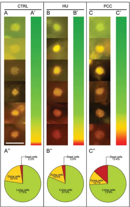 Fig 4. Double in vivo staining with acridine orange (AO) and ethidium bromide (EB) as a useful tool for detecting and quantifying the state of dead, dying and living cells in root meristems of Vicia faba 