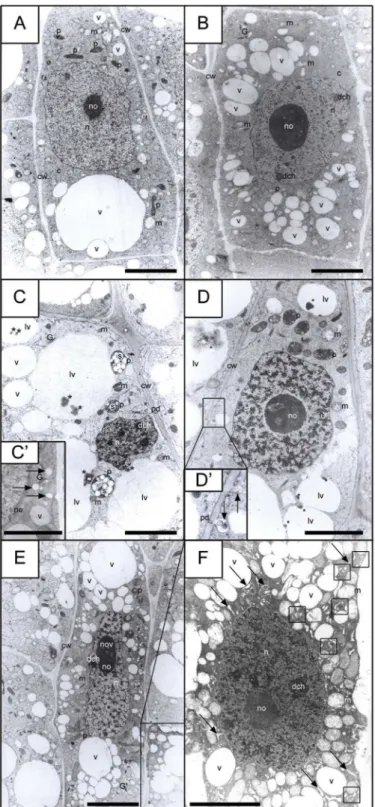 Fig 6. Electron micrographs of Vicia faba root meristem cells. (A) control (32-h incubation in water); (B) hydroxyurea-treated (32-h); (C-C', D-D', E-F) hydroxyurea (HU) synchronized for 24 h and then HU/CF  co-treated (for a successive 8 h; total incubati
