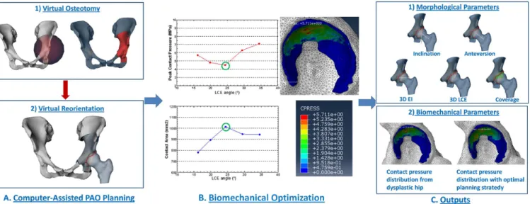 Fig 1. The schematic workflow of computer assisted planning of PAO with biomechanical optimization