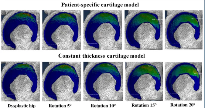 Fig 3. Contact pressure distribution obtained by using two different cartilage models at different acetabular reorientation position.
