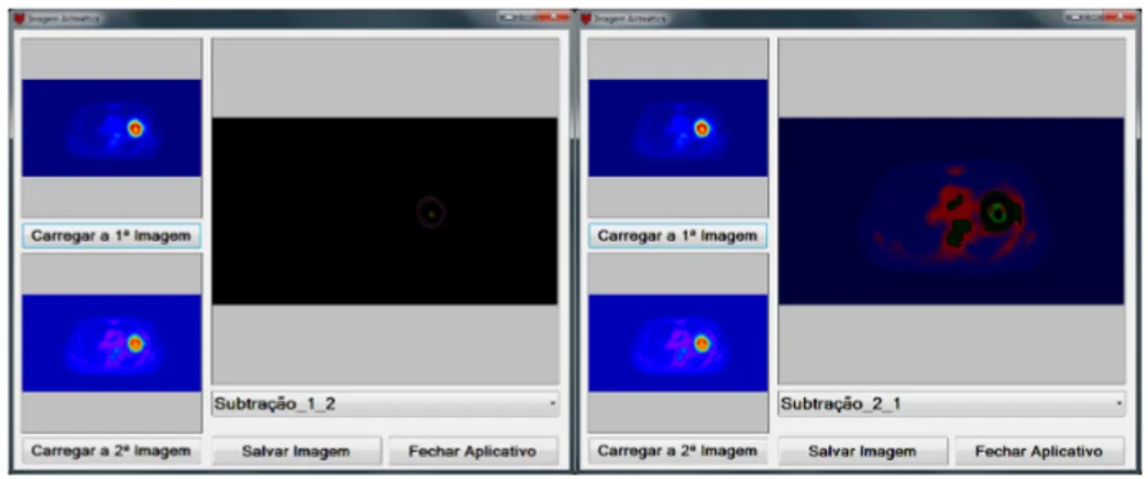 Figura 4: Polimento da Fig. 2a com máscara de média 3 x 3, usando a abordagem  RGB (1ª imagem) e a HSI (2ª imagem).