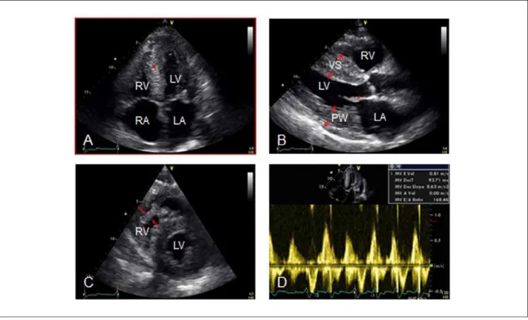 Figure 3.  Cardiac MRI.