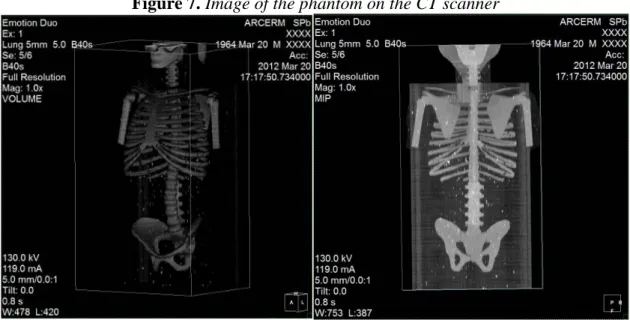 Figure 7. Image of the phantom on the CT scanner 