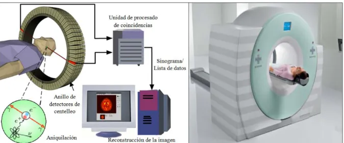 Figura 2. Tomógrafo PET, posición del paciente dentro del gantry. 