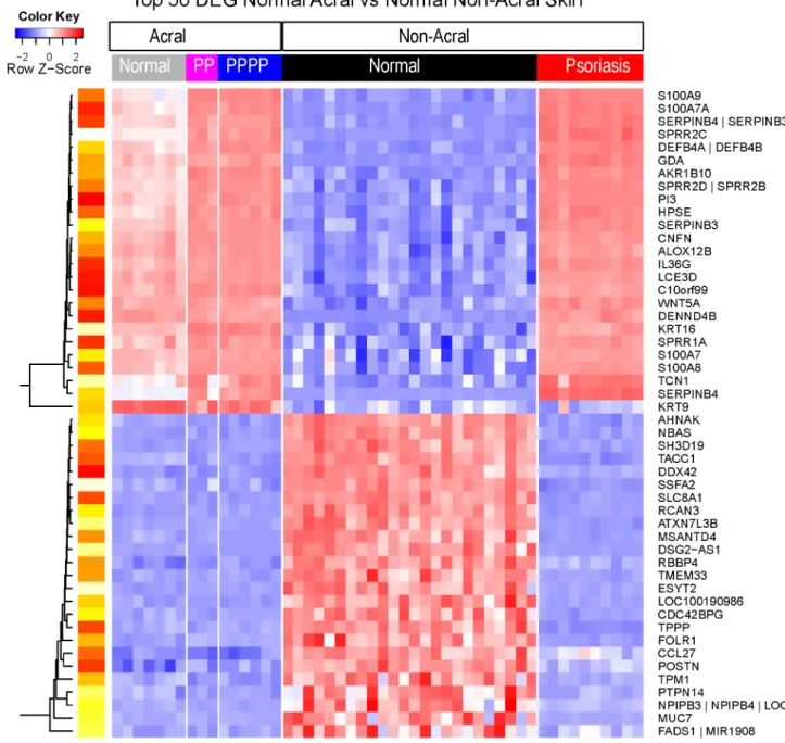 Fig 2. Heat map representing the expression profiles of the top 50 differentially expressed genes (DEG) of normal acral versus normal non-acral skin
