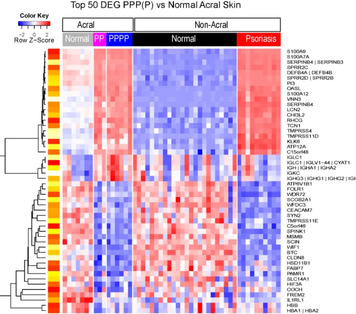 Fig 3. Heat map representing the expression profiles of the top 50 differentially expressed genes (DEG) of PPP/PPPP versus normal acral skin