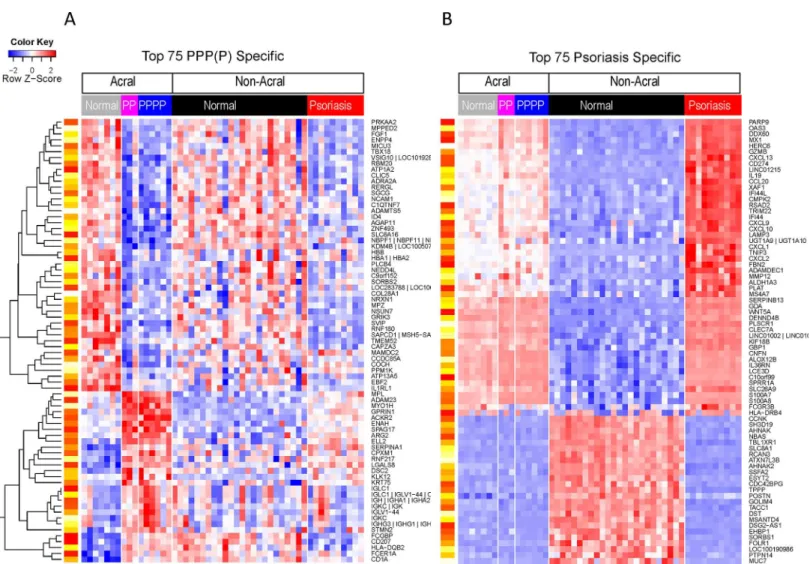 Fig 4. Heat map representing the expression profiles of the top 75 PPP/PPPP specific (A) and psoriasis specific (B) genes