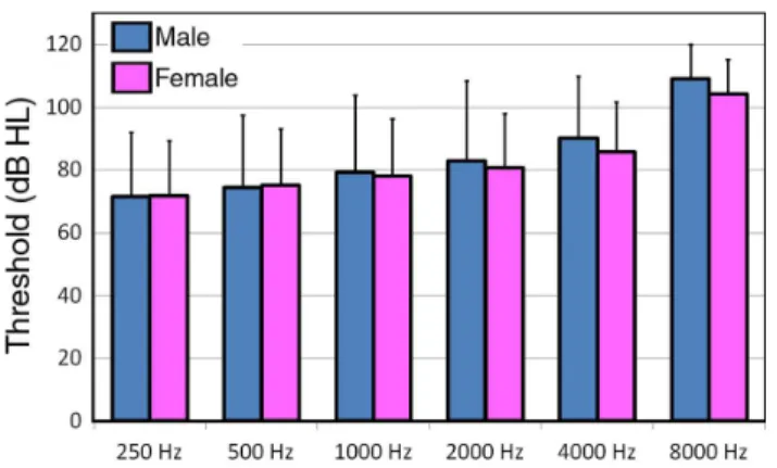 Figure 6. Comparison of hearing thresholds between men and women at different frequencies