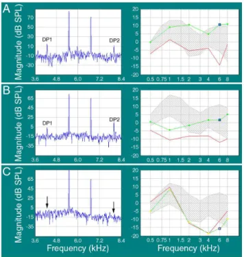 Figure 8. Number of ears (presented in percentage) that had detectable DPOAEs at different frequencies from different age groups