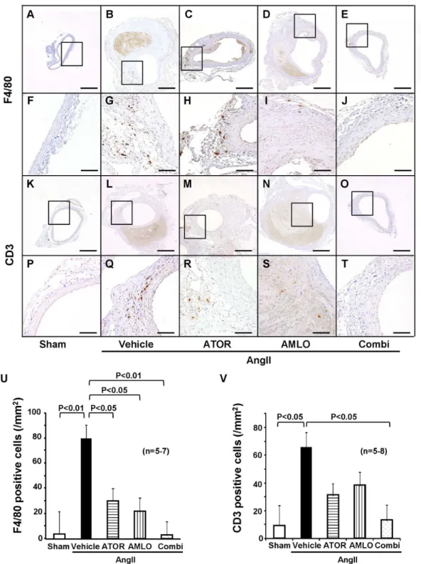 Figure 3.  Combination therapy suppresses inflammatory cells infiltration at the AngII-induced abdominal aortic aneurysm in ApoE -/-  mice