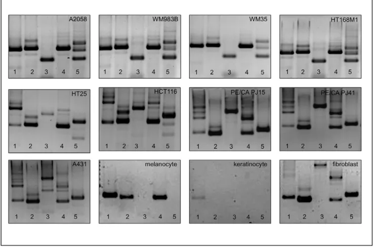 Figure 7B) were then re-implanted subcutaneously into newborn animals. Cell cultures were then created from three different localisations of the primary tumour (PNM) and three random lung metastases (MPNM) of the chosen animal (Fig