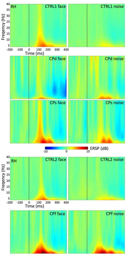 Figure 6. Time-frequency plot of the grand average event-related power for CTRL1, CTRL2 and for the three CP participants, as well as for face and noise stimuli separately