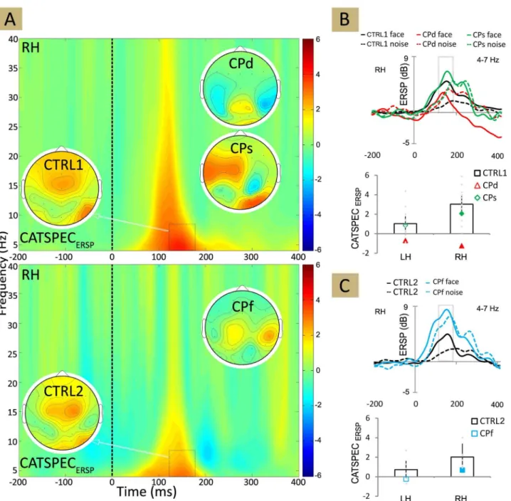 Figure 7. Time-frequency plot of ERSP. (A) The plot showing the difference in ERSP (event-related spectral perturbation) for face minus non-face stimuli for CTRL1 (upper panel) and for CTRL2 (lower panel)
