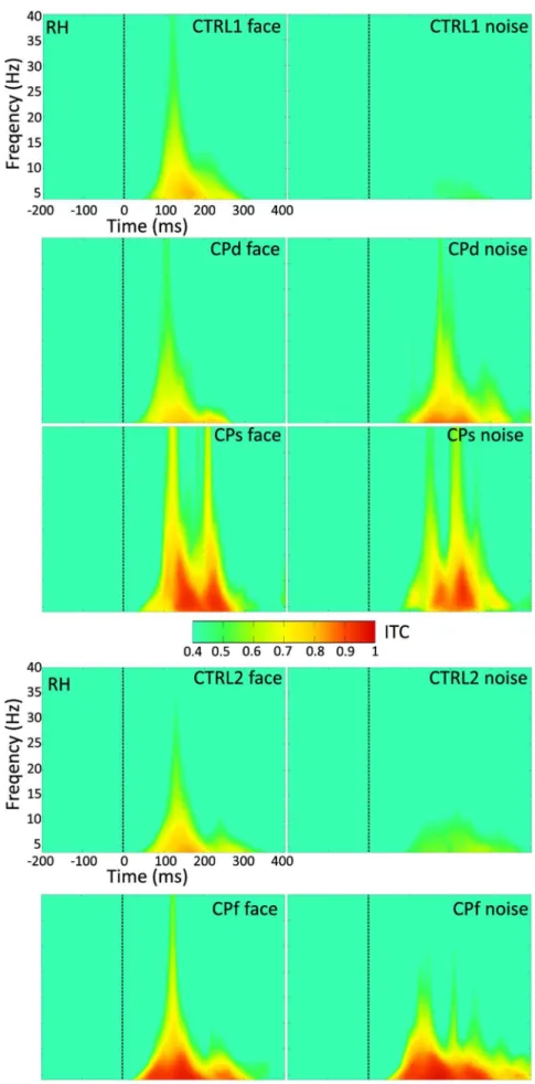 Figure 4. Time-frequency plot of the grand average ITC (intertrial coherence) for CTRL1, CTRL2 and for the three CP (congenital prosopagnosic) participants, as well as for face and noise stimuli separately