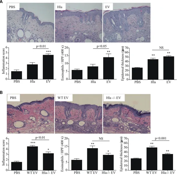 Figure 7. a -Hemolysin-positive S. aureus EVs induces atopic dermatitis-like skin inflammation