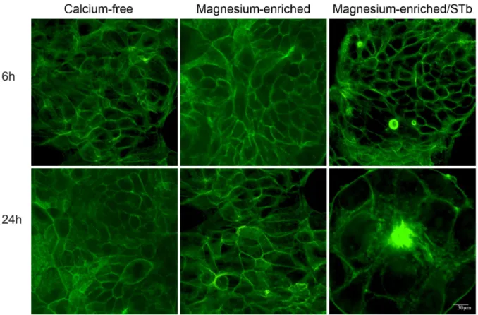 Figure 7. Effect of Mg ++ -enrichment on the rate of STb toxin activity. Cells grown in calcium-free and magnesium-enriched (1.8 mM) media were compared after 6 and 24 h